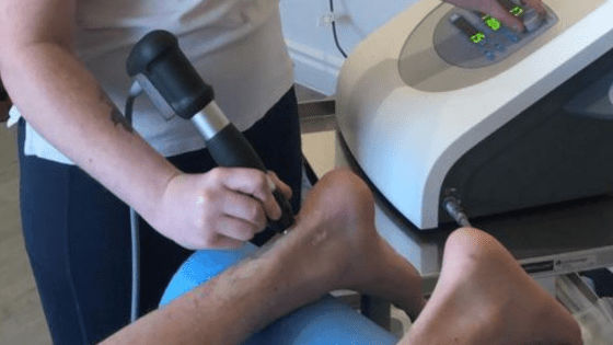 Shockwave Therapy For Achilles Tendinopathy