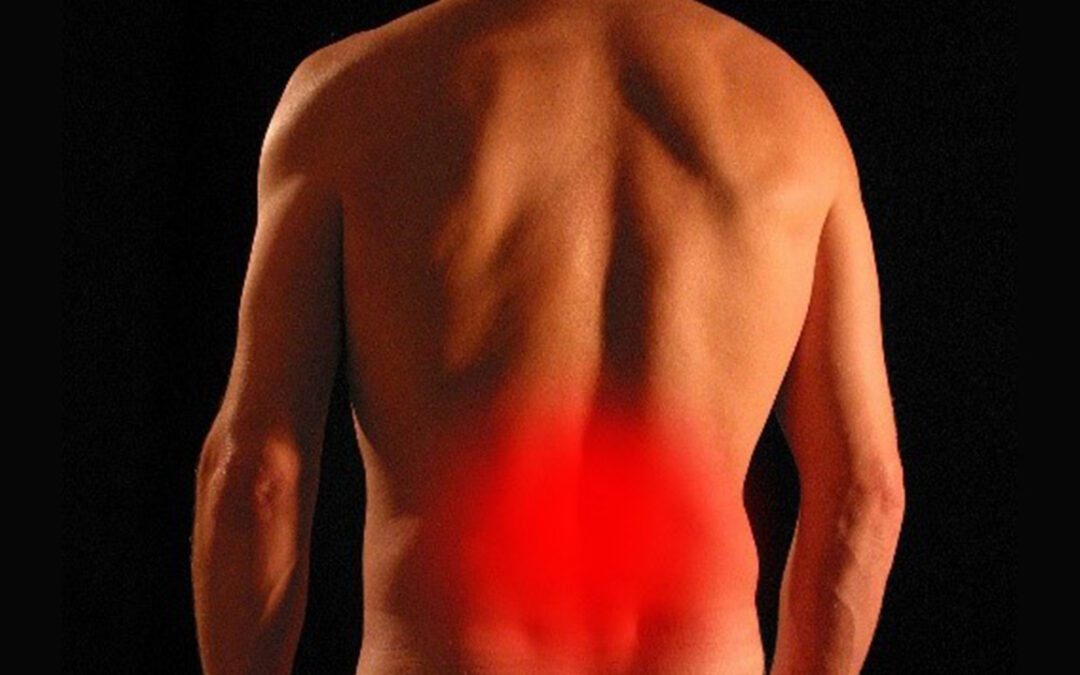Referred Pain – Is it Sciatica?