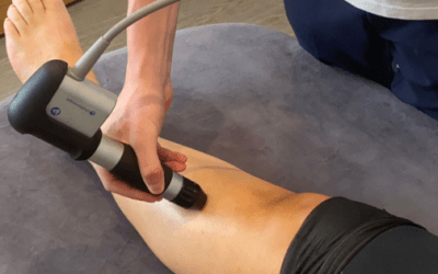 Shockwave Therapy For Shin Splints (MTSS)